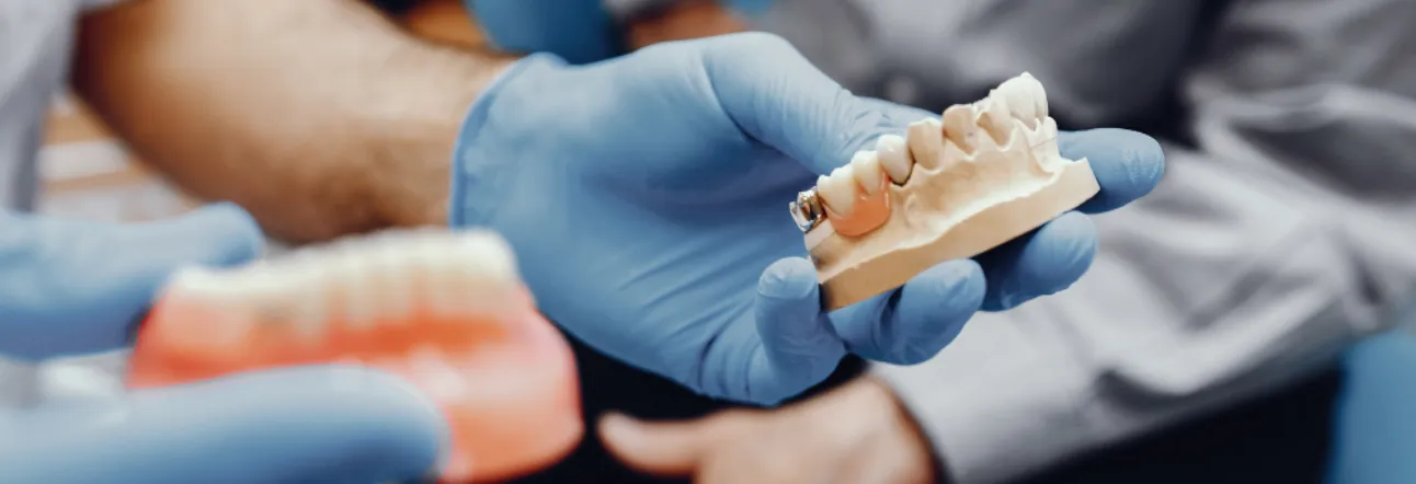 Implantes dentales en Valledupar y Barranquilla - Dr. Maya