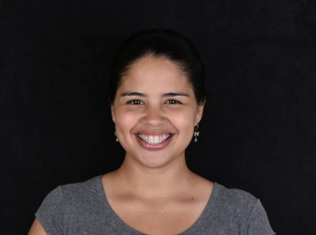 Ortodoncia Brackets CCO system