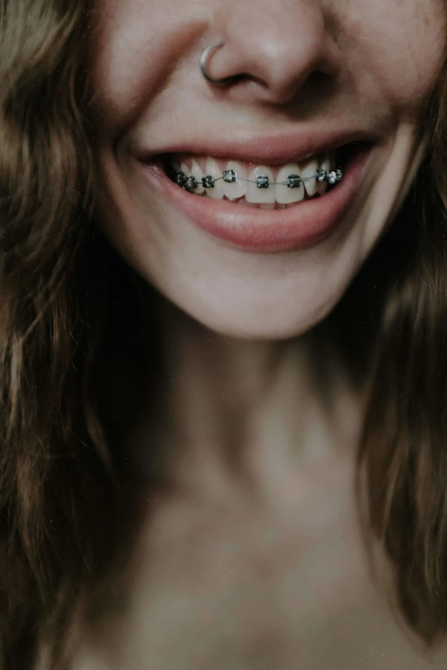 Diferencia entre diseño de sonrisa y ortodoncia